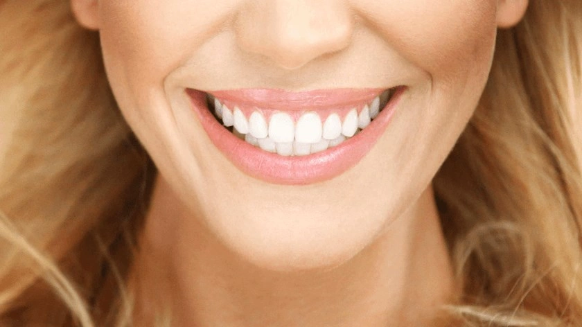 Porcelain Veneers vs. Teeth Whitening: Which Is Right for You?