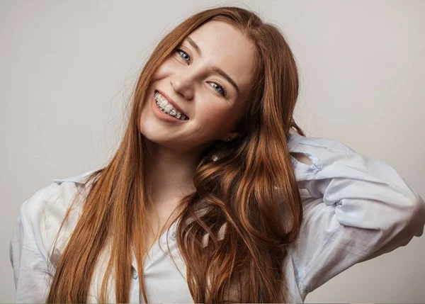 Clear Braces