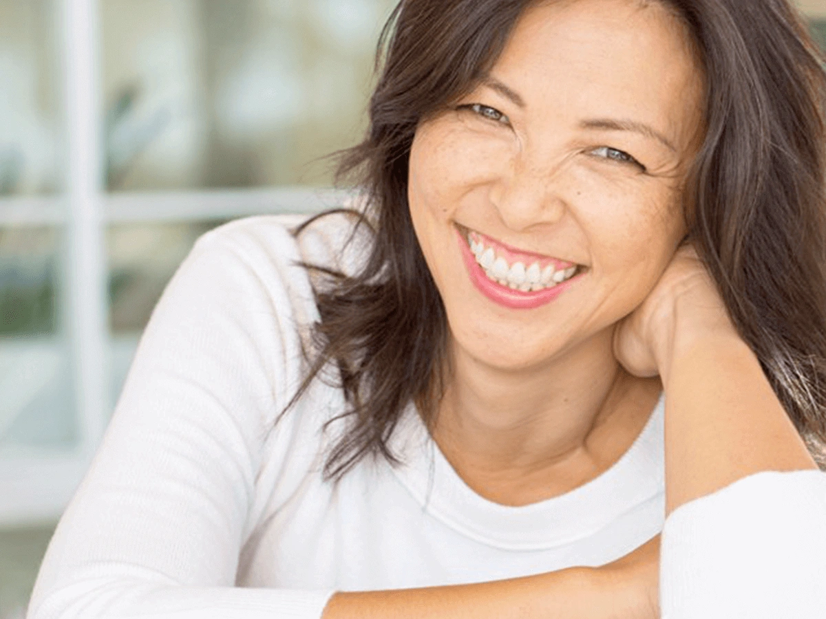 Smile Makeover Work